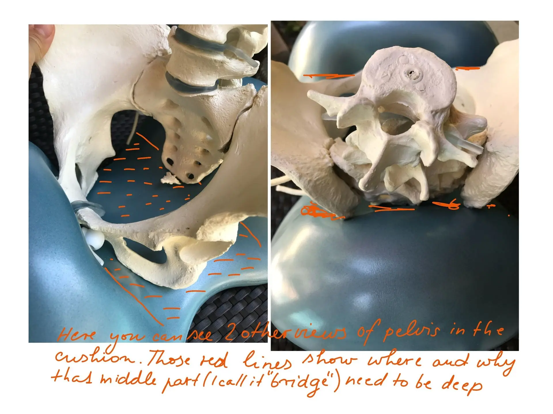 A skeletal pelvis model on the Air8 Cushion